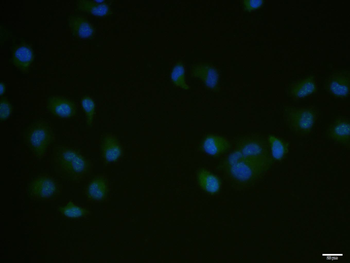 Bcl-2 Rabbit Polyclonal Antibody