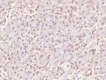 Bcl-2 Rabbit Polyclonal Antibody