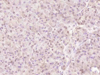 Bcl-2 Rabbit Polyclonal Antibody