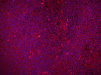 Bcl-2 Rabbit Polyclonal Antibody