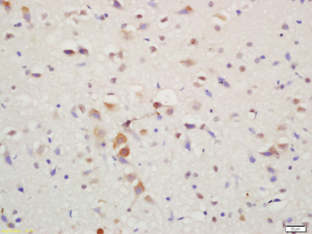 Bcl-2 Rabbit Polyclonal Antibody