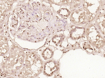 PRMT6 Rabbit Polyclonal Antibody