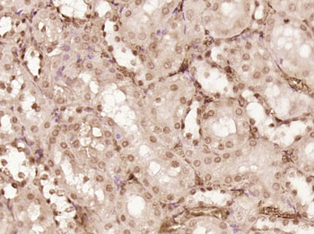 PRMT6 Rabbit Polyclonal Antibody