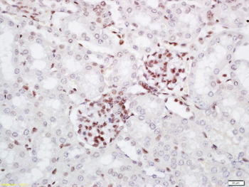 PRMT6 Rabbit Polyclonal Antibody