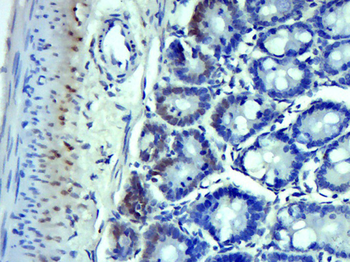 SMYD2 Rabbit Polyclonal Antibody