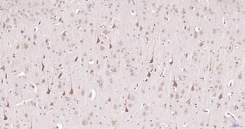 SMYD2 Rabbit Polyclonal Antibody
