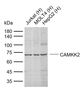 CAMKK2 Rabbit Polyclonal Antibody