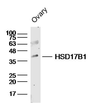 HSD17B1 Rabbit Polyclonal Antibody
