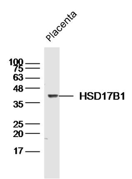 HSD17B1 Rabbit Polyclonal Antibody