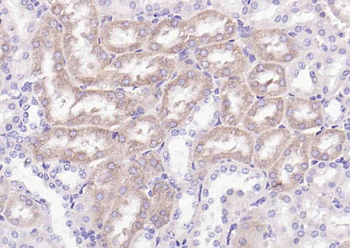 BCAT1 Rabbit Polyclonal Antibody