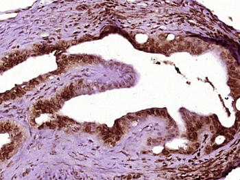 FOXL2 Rabbit Polyclonal Antibody