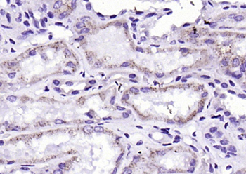 AMACR Rabbit Polyclonal Antibody