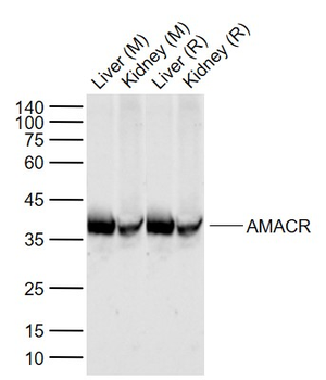 AMACR Rabbit Polyclonal Antibody