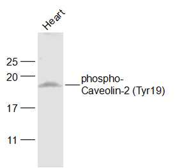 Phospho-Caveolin-2 (Tyr19) Rabbit Polyclonal Antibody