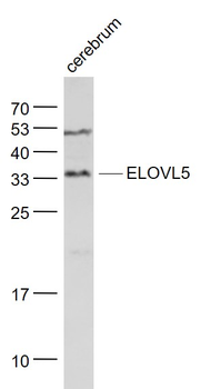 ELOVL5 Rabbit Polyclonal Antibody