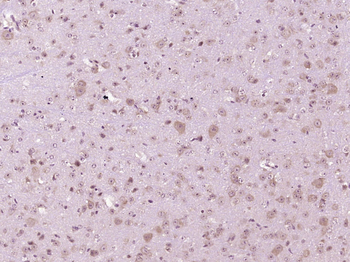 NPC1 Rabbit Polyclonal Antibody