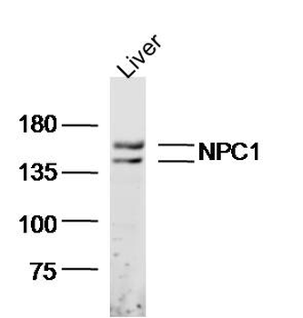 NPC1 Rabbit Polyclonal Antibody