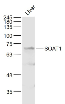 SOAT1 Rabbit Polyclonal Antibody