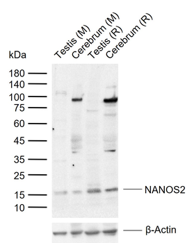 NANOS2 Rabbit Polyclonal Antibody