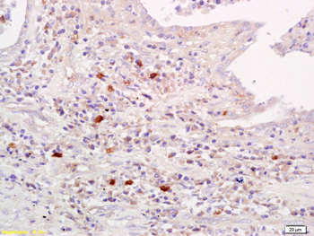 Amylin Rabbit Polyclonal Antibody