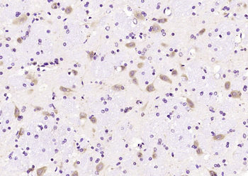 NALP12 Rabbit Polyclonal Antibody