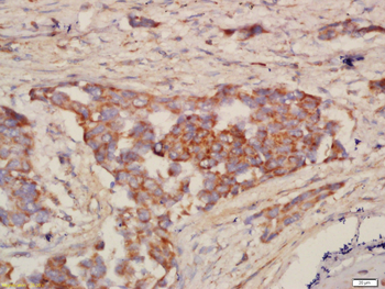 NALP12 Rabbit Polyclonal Antibody