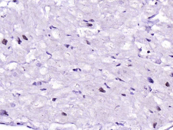 Nkx2.5 Rabbit Polyclonal Antibody