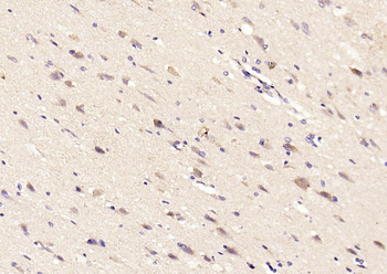 TSSC3 Rabbit Polyclonal Antibody