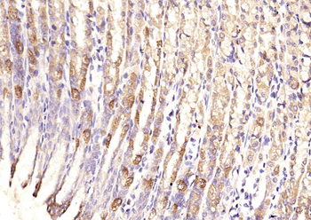 TSSC3 Rabbit Polyclonal Antibody