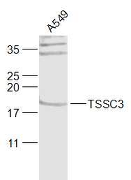 TSSC3 Rabbit Polyclonal Antibody