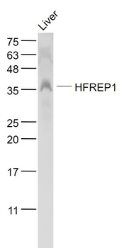 HFREP1 Rabbit Polyclonal Antibody