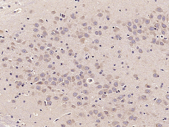 NEK1 Rabbit Polyclonal Antibody
