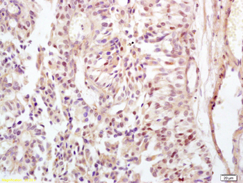 CDCA8 Rabbit Polyclonal Antibody