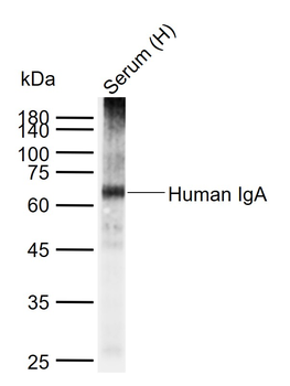 Human IgA Rabbit Polyclonal Antibody