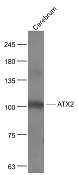 ATX2 Rabbit Polyclonal Antibody