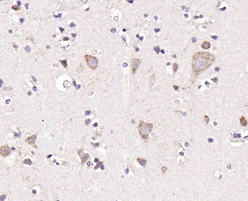 ADAM9 Rabbit Polyclonal Antibody