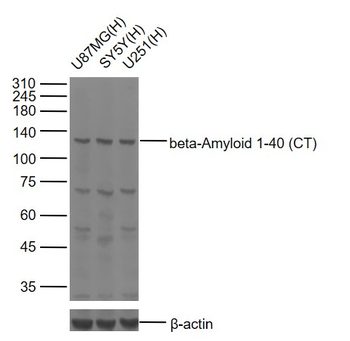 Beta-Amyloid 1-40 (CT) Rabbit Polyclonal Antibody