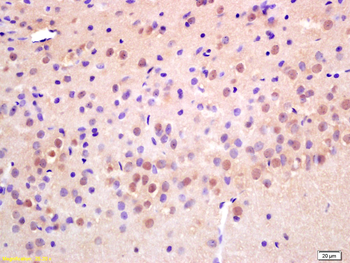 RAD21 Rabbit Polyclonal Antibody