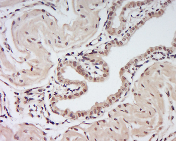 Phospho-Mst2 (Thr180) Rabbit Polyclonal Antibody