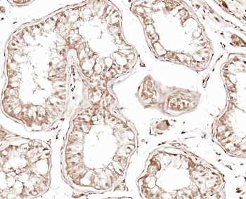 CABLES2 Rabbit Polyclonal Antibody