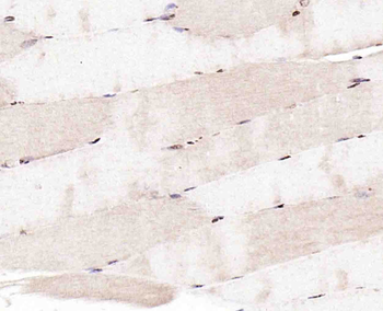 CABLES2 Rabbit Polyclonal Antibody