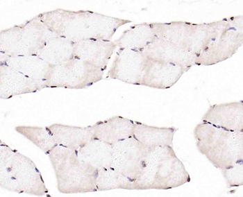 CABLES2 Rabbit Polyclonal Antibody