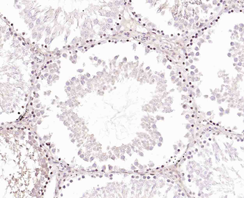 CABLES2 Rabbit Polyclonal Antibody