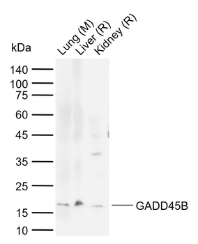 GADD45B Rabbit Polyclonal Antibody