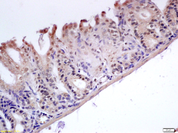 GADD45B Rabbit Polyclonal Antibody