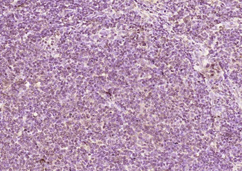 IMPDH2 Rabbit Polyclonal Antibody