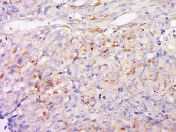 Angiopoietin 2 Rabbit Polyclonal Antibody