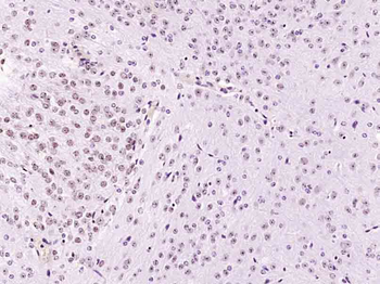 NBN Rabbit Polyclonal Antibody