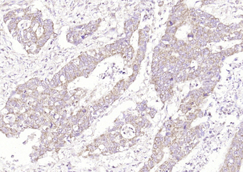 GRAP2 Rabbit Polyclonal Antibody