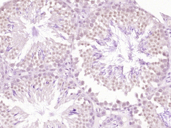 TKTL1 Rabbit Polyclonal Antibody